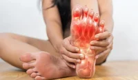 Wanita Sakit Asam Urat Kaki Meradang